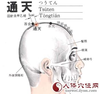 通天穴|医砭 » 经穴库 » 通天